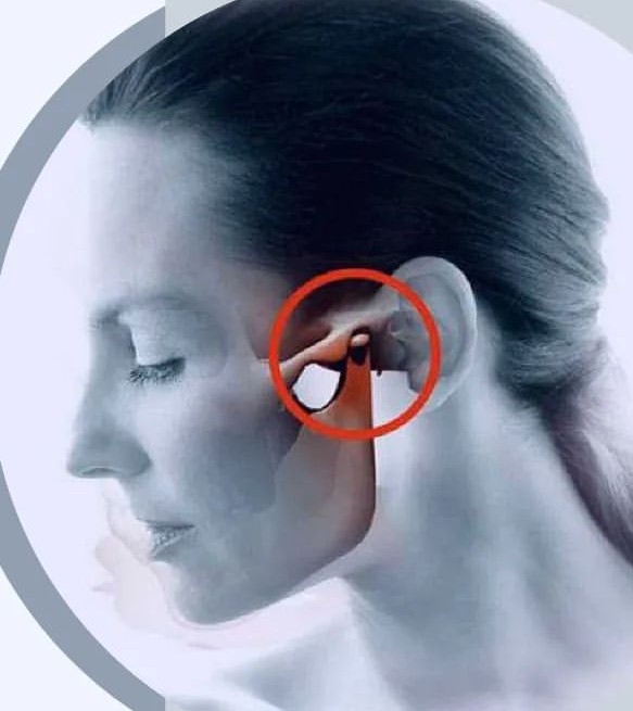 Disfunciones de la articulación temporomandibular